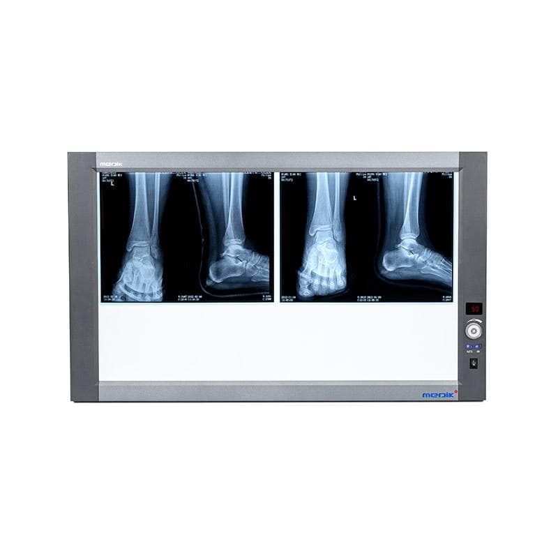 Double Panel X-Ray Film Viewer thumbnail 2