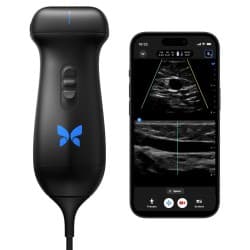 Butterfly Handheld Ultrasound System – iQ3™ thumbnail 2