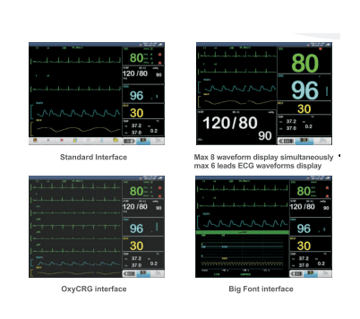 AV-PRO XL 15” Multi-Parameter Patient Monitor – Advanced ICU/CCU Monitoring Solution thumbnail 2
