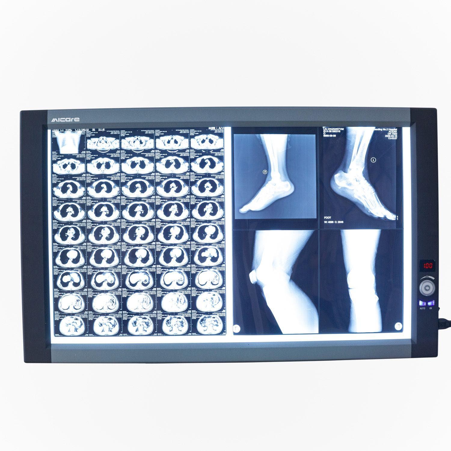 Double Panel X-Ray Film Viewer