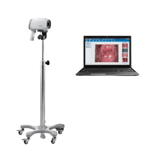 EDAN C6A Video Colposcope